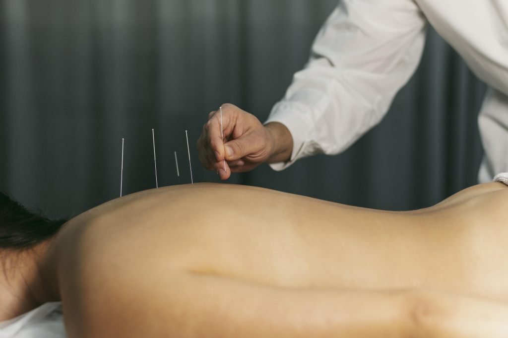 Acupuncturist in Apeldoorn