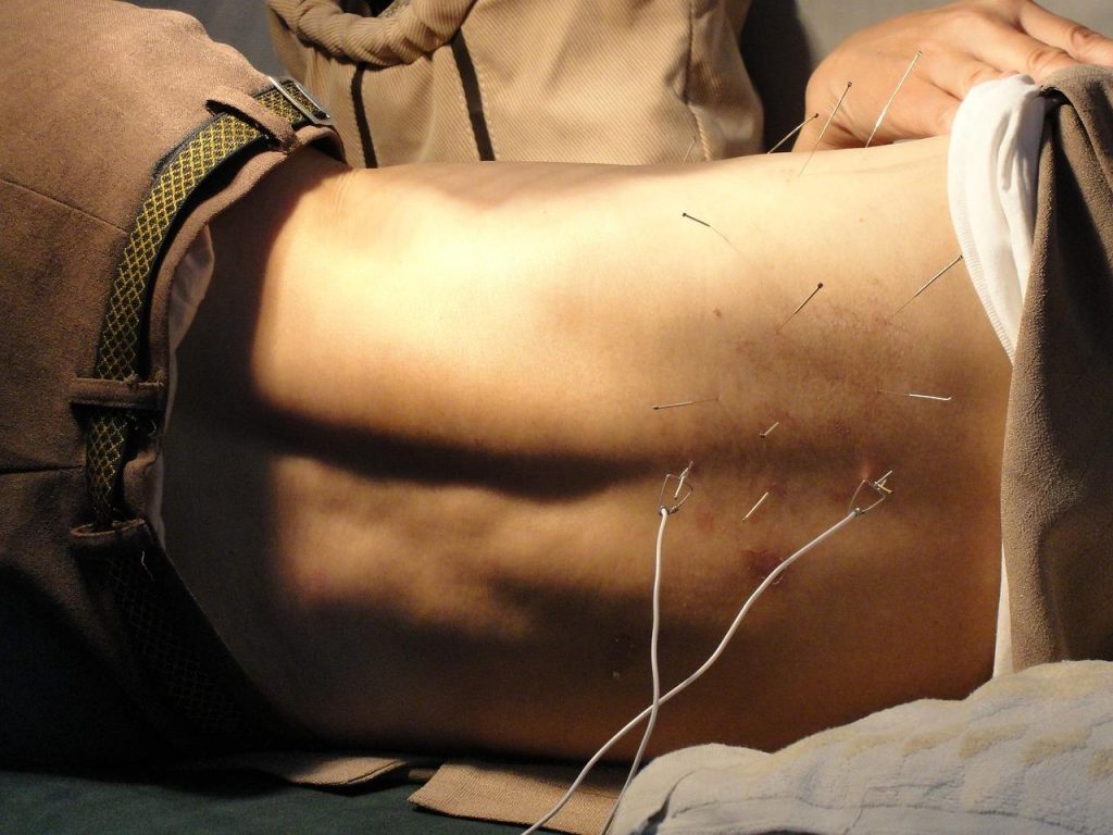 Acupuncturist in Apeldoorn